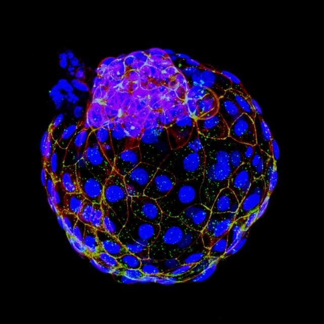 胚盤胞を模した新構造は、ヒトの初期発生の研究に役立つとUTSWの研究者がNature誌に発表