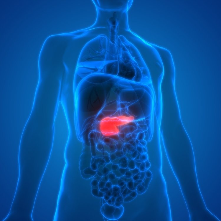 オルガノイドモデルを用いた膵臓がんの新しい治療法の可能性
