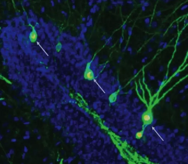 神経細胞の形成促進により、アルツハイマー病のマウスの記憶が回復。ニューロンの生産を高めることがアルツハイマー病患者の治療戦略として有効である可能性が示唆された。