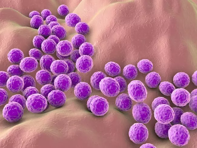 メチシリン耐性黄色ブドウ球菌を抑制し、抗生物質に対してより脆弱にする化合物を発見。