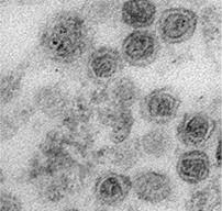エクソソームによるアプローチが後期大腸癌の治療に有効であることが前臨床モデルで示された