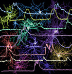 NIH、BRAIN Initiativeに初回4,600万ドルの資金