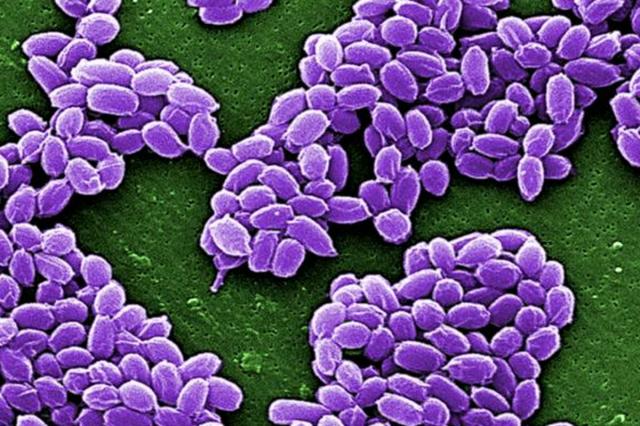 家畜および野生生物の炭疽症に対する経口ワクチン開発に進展