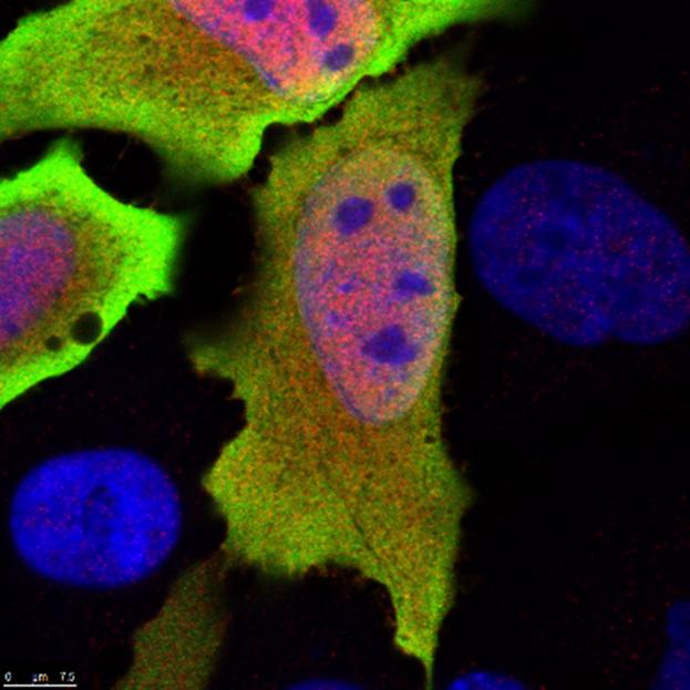オーストラリア連邦科学産業研究機構が特定のサイトカインの産生を調節する遺伝子を同定