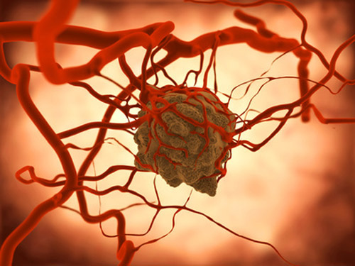 循環血中腫瘍DNAによる液体生検は肺がんのEGFR遺伝子変異発見に有用