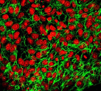 免疫療法抵抗性腫瘍はリンパ節に移動して免疫細胞活性化を遠隔的に阻害するPD-L1が詰まったエクソソームを輸送することが発見された