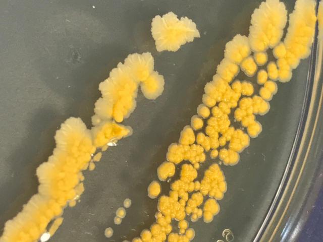 極地生物の不凍タンパク質が革命的な細菌凍結保存技術の開発を促す