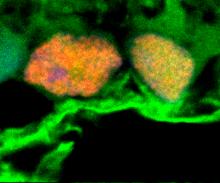 幹細胞エキソソームが網膜神経節細胞の生存を高める。緑内障治療にも応用可能か