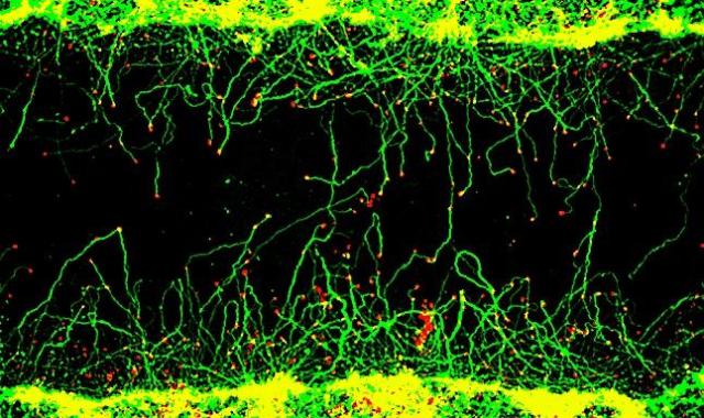 タンパク質間相互作用を安定化する天然分子が軸索再生を刺激。脊髄損傷や卒中の標的候補になり得るか?