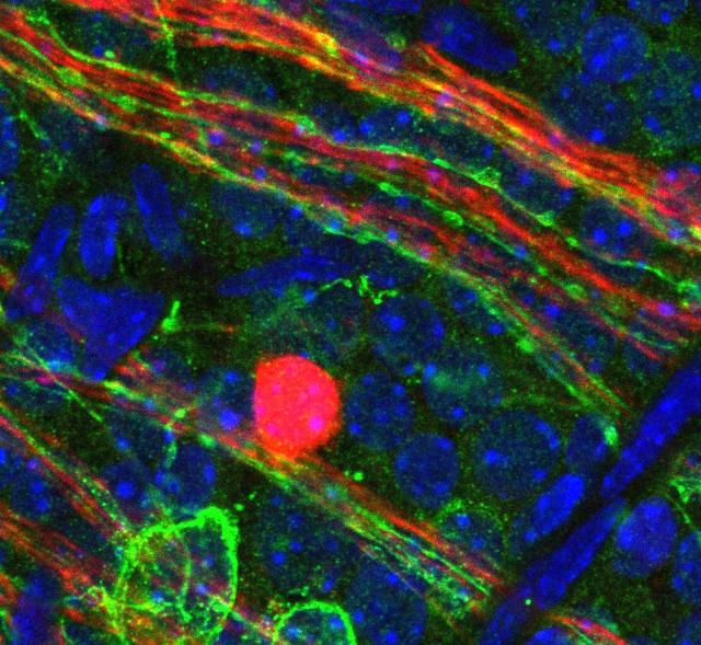 眼の血管の発達を調節する光依存性分子パスウェイが発見された。未熟児網膜症と近視の未熟児の治療に光線療法の可能性を示す。