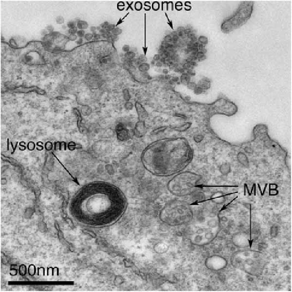移植幹細胞由来エクソソームは心臓発作からの回復を助ける。移植細胞からの循環エキソソーム解析(液体生検)は医師が回復の程度を把握することを可能にする。