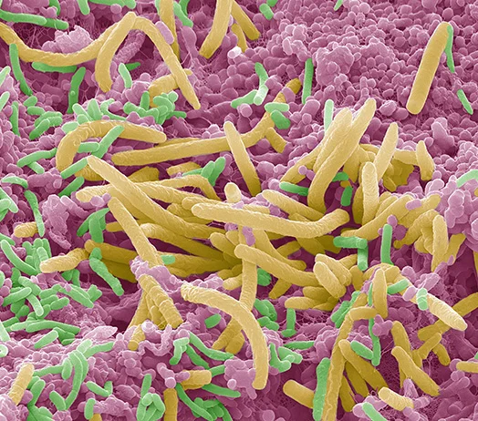 舌の微生物は心不全の大規模スクリーニング、診断、および長期モニタリングに役立つ可能性が示唆された