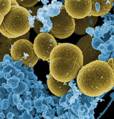 MRSAの抗生物質感受性をシングルセル解析で迅速に判別