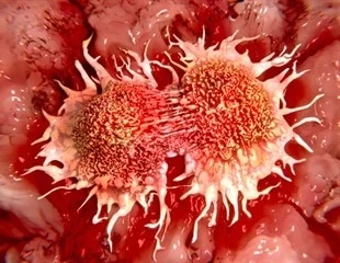 癌細胞におけるワールブルク効果について100年前からの謎が解明