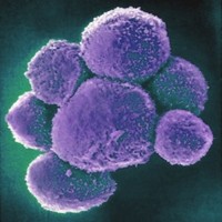 ナチュラルキラー細胞が肺がん感受性の多様性のカギとなるようだ