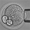 IVF受精卵の柔らかさで胚生存率を予測し単一胚移植の成功率を向上