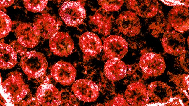 血液型とCOVID-19の重篤化リスクについての関連性がNEJMで発表