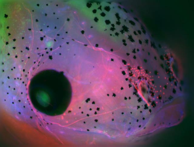 胚における脳の発達は、細菌性病原体を感知し免疫細胞にシグナルを送る自然免疫の重要な調節因子であることが発見された