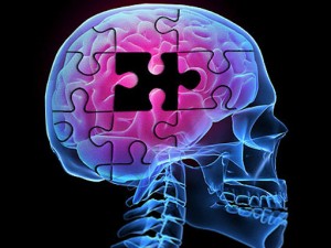 アルツハイマー病を治療できる可能性がある新しい分子の研究
