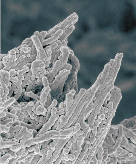 既存のニキビ薬(ミノサイクリン)が動脈硬化の予防・治療に非常に有効であることが判明
