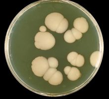 免疫システムを潜り抜ける、死を招く菌体