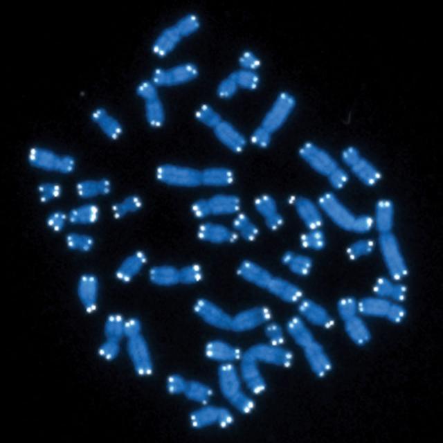 高圧酸素治療はテロメアを伸ばし老化細胞の数を減らすという、老化プロセスの停止/逆転のエビデンスが発表された