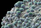 循環腫瘍細胞検出変更で前立腺がん治療予想を大幅に改善も