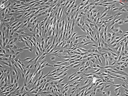細胞外小胞に含まれる因子を含む間葉系間質細胞からの分泌因子が、メチシリン耐性黄色ブドウ球菌スーパーバグによる感染症の治療に有望であることが示された
