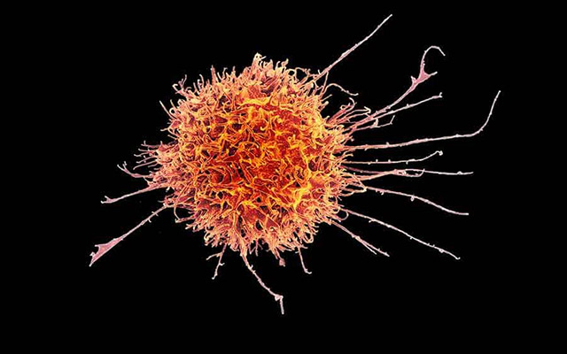 幹細胞によるインプラントで1型糖尿病患者におけるインスリンの分泌に成功