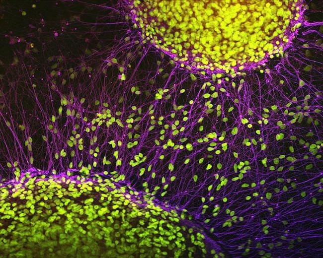 新技術で脳細胞の老化を追跡:脳の老化プロセスを理解する新たな手段
