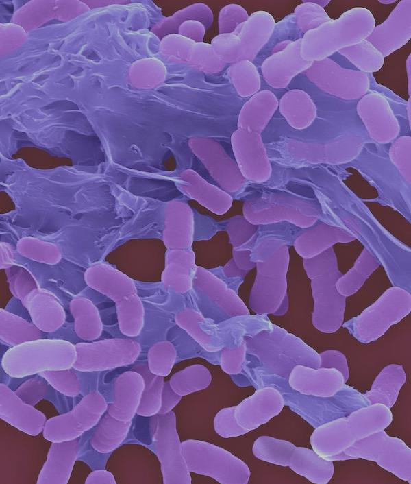 新発見の抗生物質ゾスラバルピン、抗生物質耐性アシネトバクター・バウマニに対する効果を実証