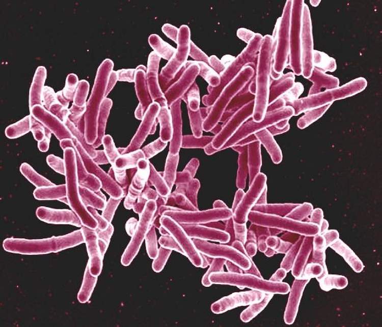 結核を引き起こすマイコバクテリウムの遺伝子発現の謎に迫る
