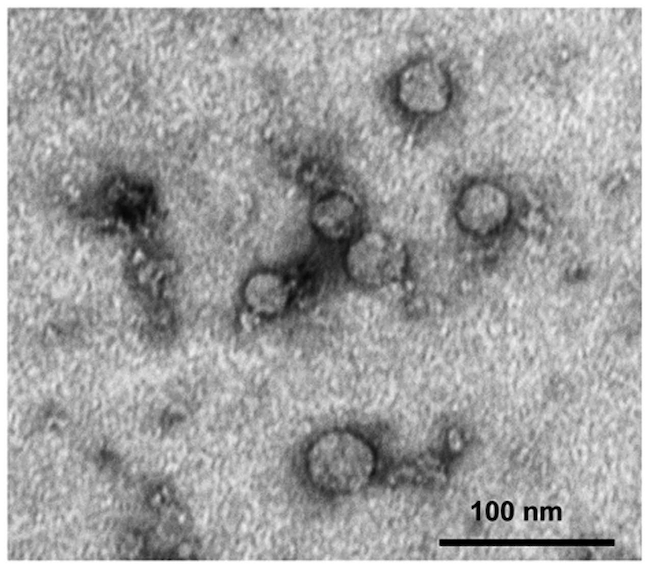Coya Therapeutics社、CTLA-4タンパク質を持つTreg由来エクソソームを開発。新技術で免疫細胞への標的治療が可能に。