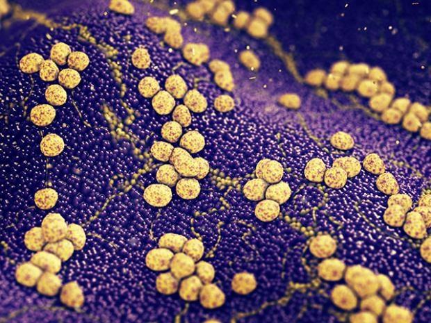 死亡率の高い耐性スーパーバグ感染症の背後にある遺伝子がGWASを用い発見された