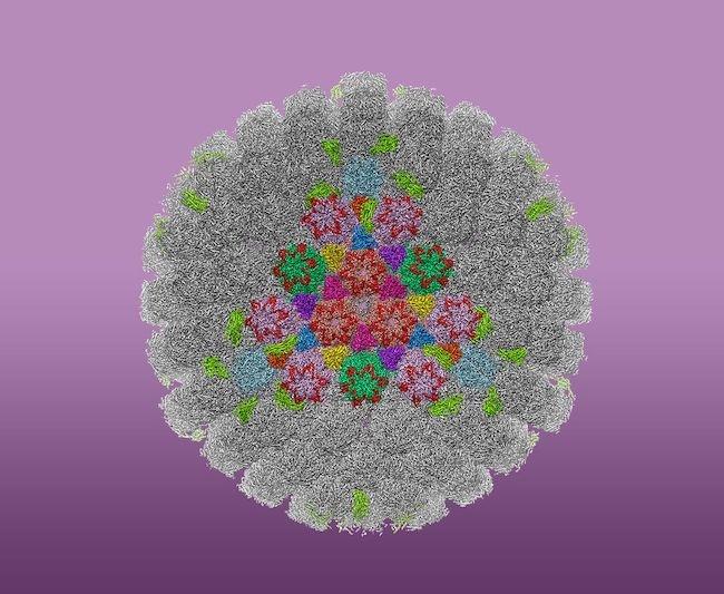 遺伝子治療が膠芽腫に有効:再発グリオブラストーマ患者の生存延長を示す