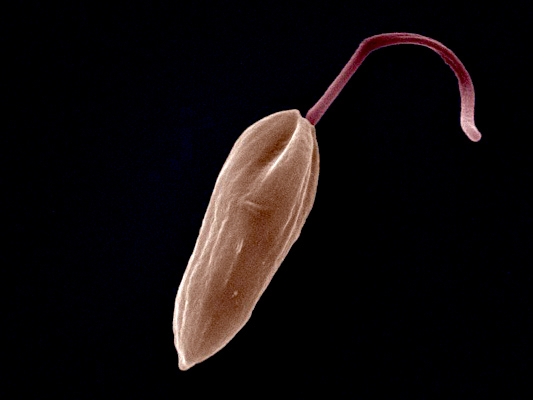 なぜリーシュマニア症は痛みを伴わないのか?寄生虫疾患の痛みの知覚に関する新発見