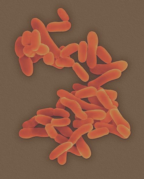 画期的な技術が結核菌の遺伝子発現の謎を解明