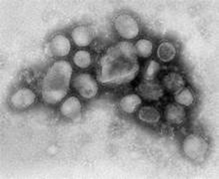 RNAウイルス防御の鍵:TRIM25の役割に迫る最新研究