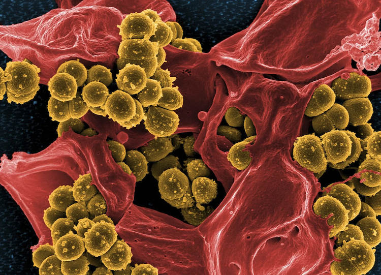 抗生物質が効かない時代の救世主?薬剤耐性菌に有効な新物質「インフュージド」を開発