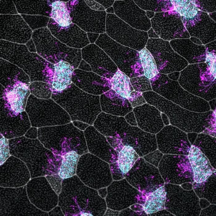 自閉症と心臓病の意外な繋がりを発見!鍵は細胞の「繊毛」にあった