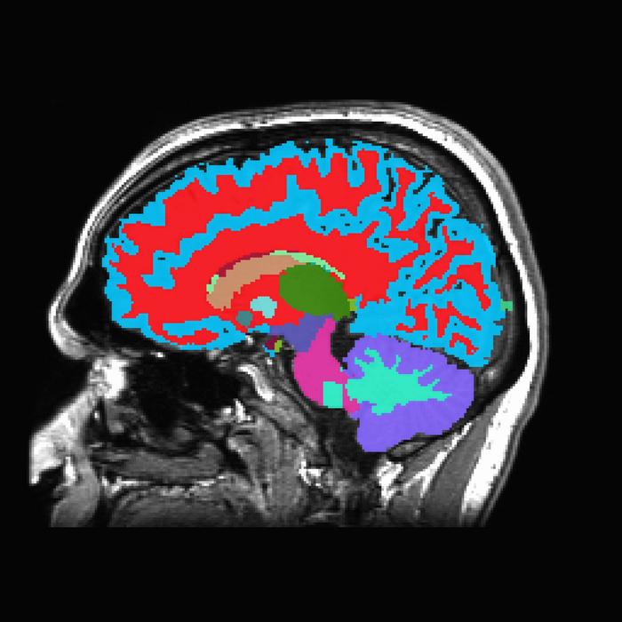 たった1枚の脳画像で将来の健康がわかる。加齢性疾患を予測する新たな老化時計