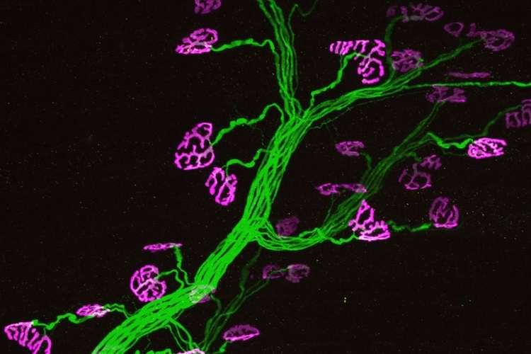 脳の「ゴミ輸送」を修理せよ！PI31タンパク質がアルツハイマー病に新たな希望