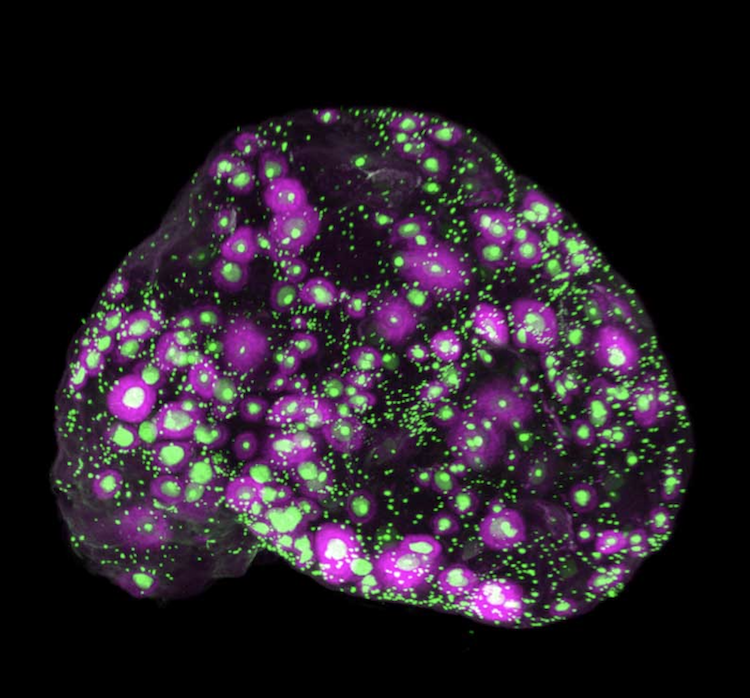 卵巣の老化は「エコシステム」で決まる？新イメージング技術が明かす真実
