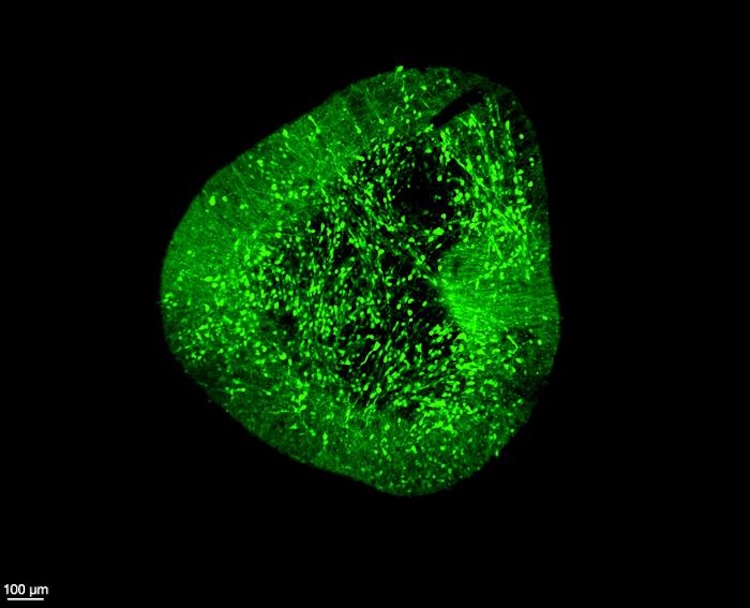 パーキンソン病治療の革命？ヒト脳の「設計図」BrainSTEMが解明する細胞の未来