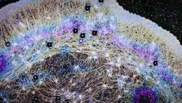 がん転移の謎を解く? 細胞内の「風」がタンパク質を運ぶ新発見