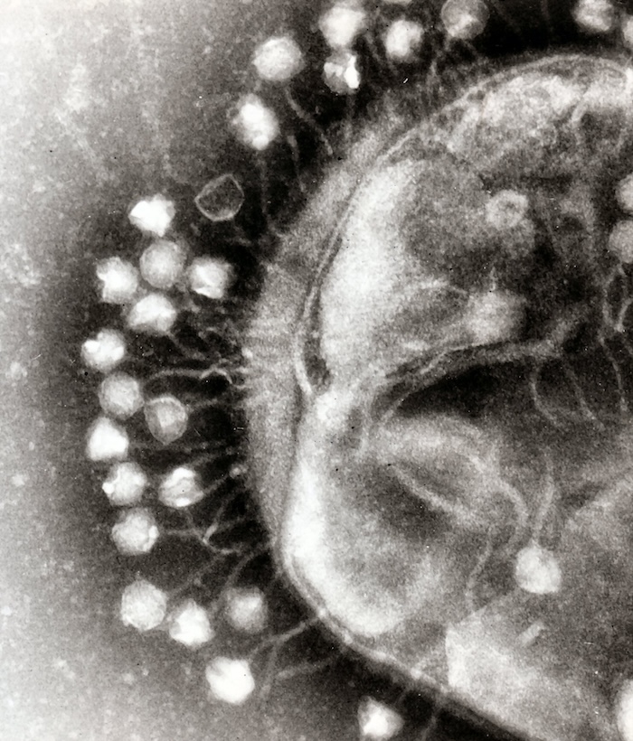 抗生物質耐性との戦いに光明、黄色ブドウ球菌のウイルス防御メカニズムとは