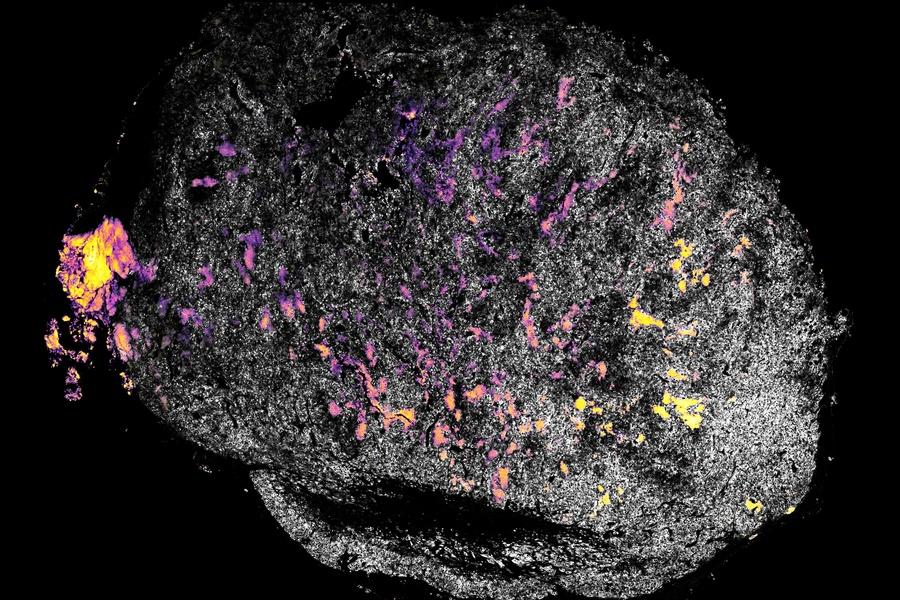 免疫系を刺激する薬剤で癌免疫療法が強化される可能性が報告された