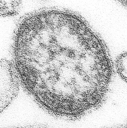 森に潜む新たな脅威:麻疹に似たウイルスが種を超えて伝播する仕組みを解明
