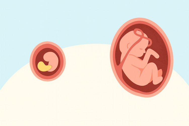 PCOSはなぜ遺伝する？母親から受け継がれる「エピジェネティックな記憶」の謎を解明