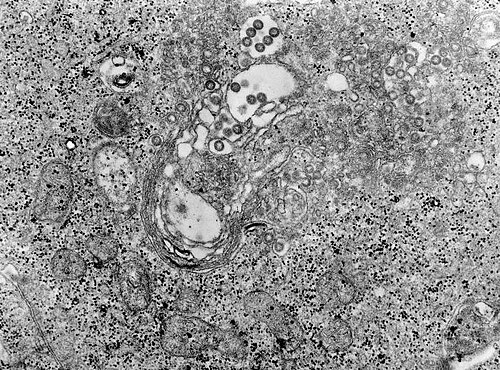 人獣共通感染症との闘い：セネガルのRVF対策と求められる迅速診断ツール